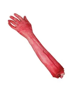 Abgehackter Arm Mit Knochenstump